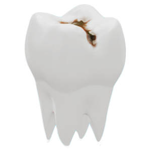 ToothModel_Before